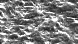 RONDOflex-plus-360_Cavity-500x-magnification_850px.jpg